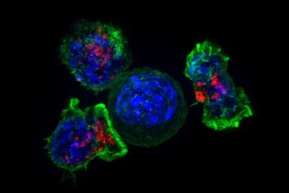 Т-клеткі-забойцы атачаюць ракавыя клеткі. Фота NIH.