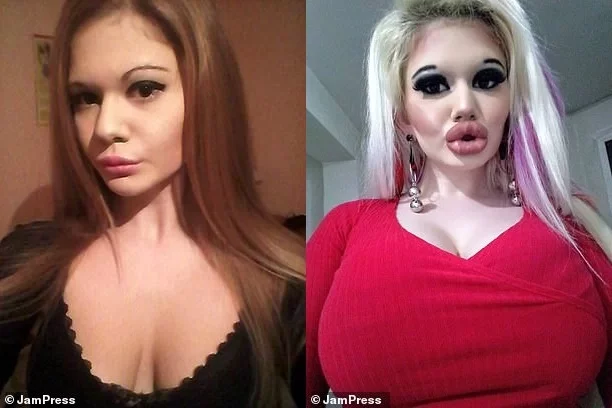 Студентка до и после косметических процедур.