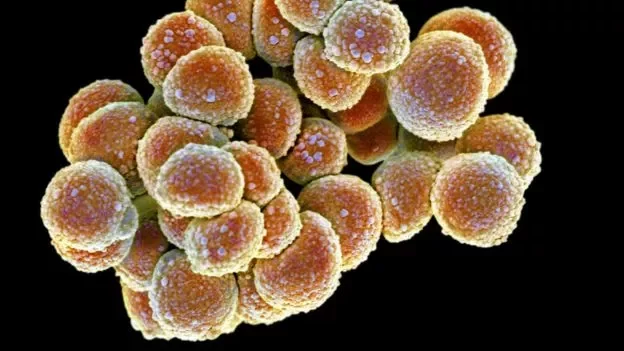 Так под микроскопом выглядит бактерия золотистого стафилококка, живущая в носу у многих людей.