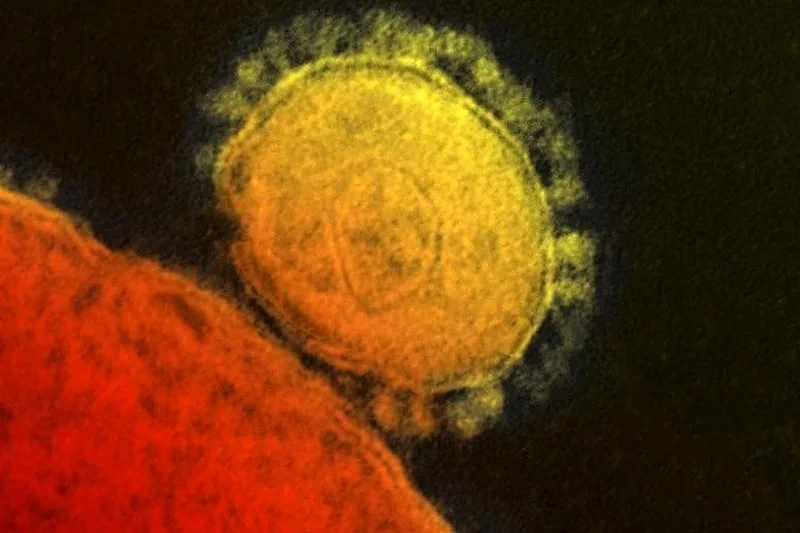 Вірус MERS. Фота: Reuters/National Institute for Allergy and Infectious Diseases