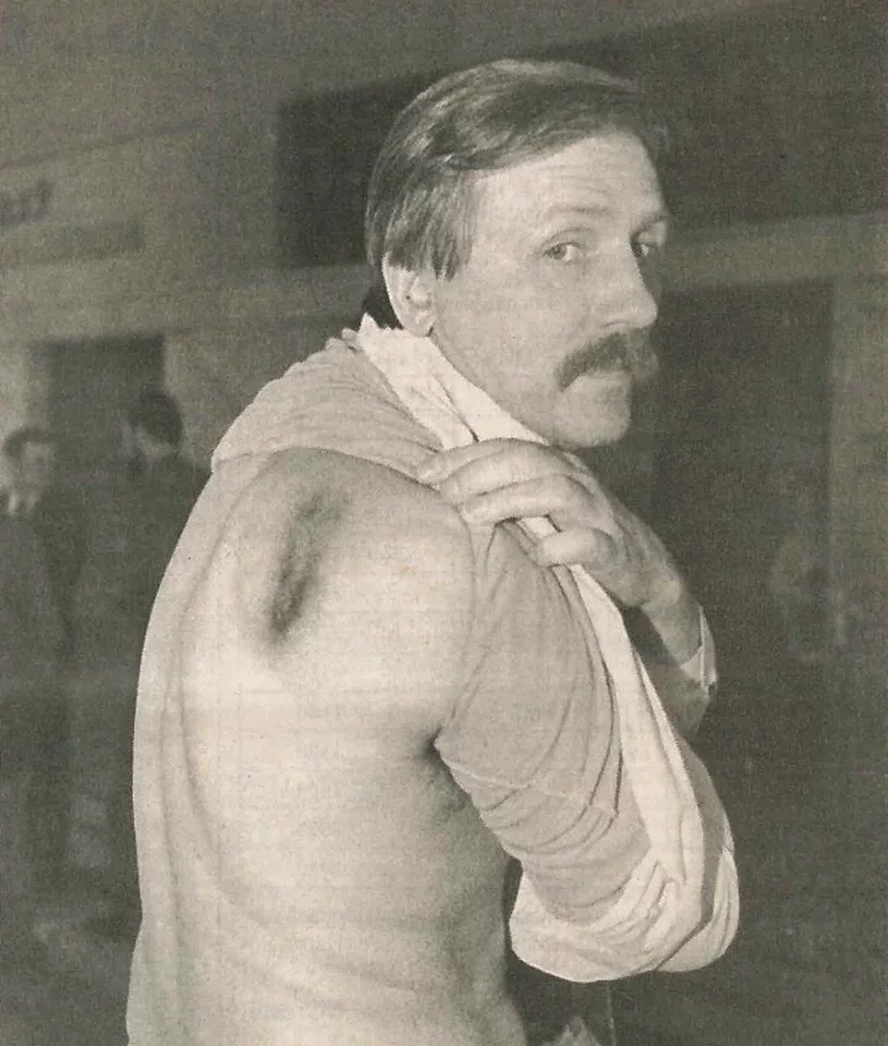 После голодовки депутатов в апреле 1995 года Александр Шут демонстрирует следы побоев.