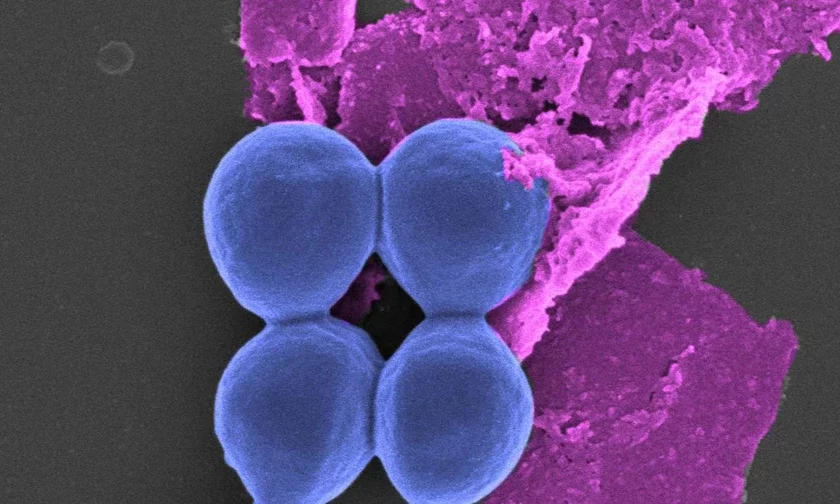 Black phosphorus and bacteria Чорны фосфар і бактэрыі Чёрный фосфор и бактерии 