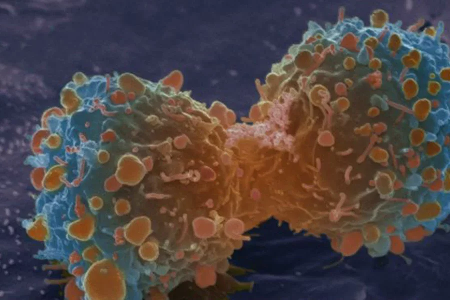 Дзяленне ракавай клеткі пры раку лёгкіх.