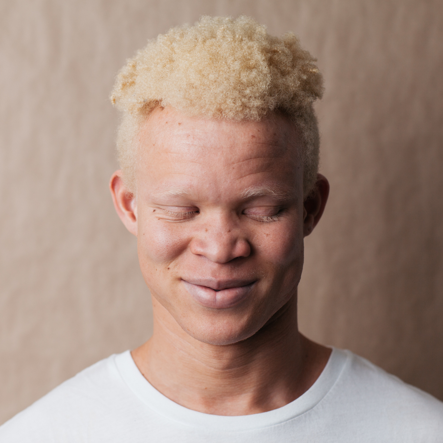 Белый негр. Альбиносы люди негроиды. Альбинос негроидной расы. Афроамериканец альбинос.